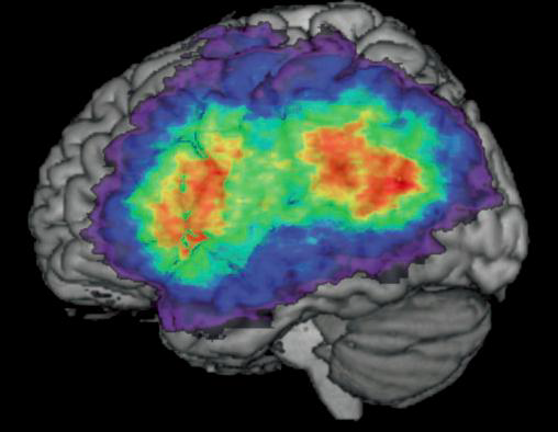 DICOM image of brain