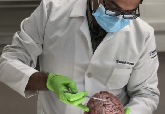 Dr. Kantak holding a brain