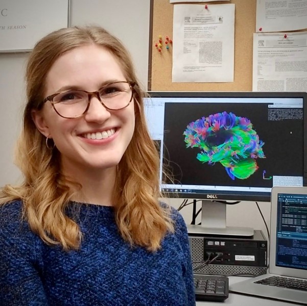 Haley standing next to an MRI image of a brain.